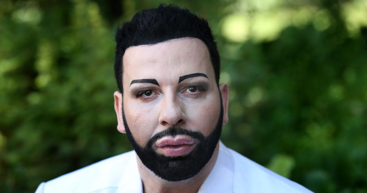 Schönheits-OP: Harald Glööckler: Zu viele Schönheits-OPs? | BUNTE.de