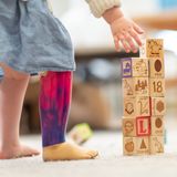 Voller Stolz: 3-Jährige mit amputiertem Bein legt Prothese erstmals allein an