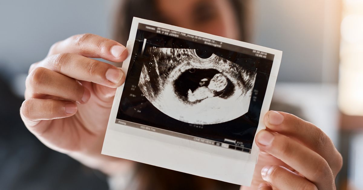Viraler Hit Unheimlich oder lustig? Dieses UltraschallBild spaltet