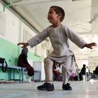 Fünfjähriger bekommt Beinprothese und kann nicht aufhören, zu tanzen