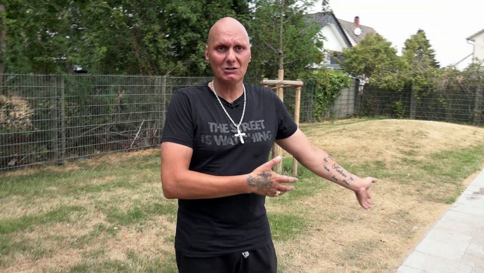 Steckt eine Krankheit dahinter? Darum hat Hartz und herzlich-Elvis keine Haare!