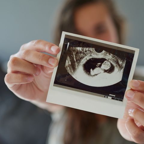 Ultraschall Schwangerschaft, Ultraschalluntersuchung, 3D Ultraschall