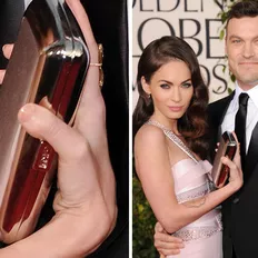 Auch die hübsche Megan Fox ist nicht perfekt: Die Schauspielerin leidet an Brachydaktylie, ihr fehlt die Hälfte ihres Daumens.