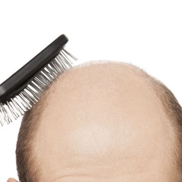 News - Mittel gegen Haarausfall: Neues Wachstum