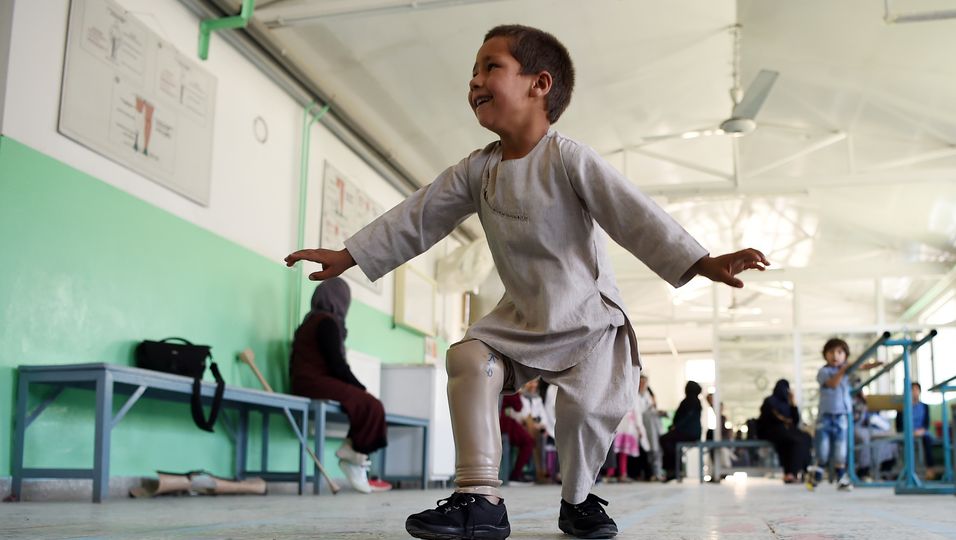 Fünfjähriger bekommt Beinprothese und kann nicht aufhören, zu tanzen