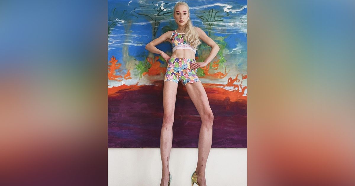 BUNTE.de Instagram-Ticker: GNTM-Star Theresia zeigt ihre verlängerten Beine