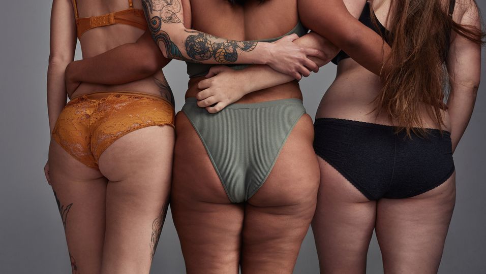 Drei Frauen mit Cellulite
