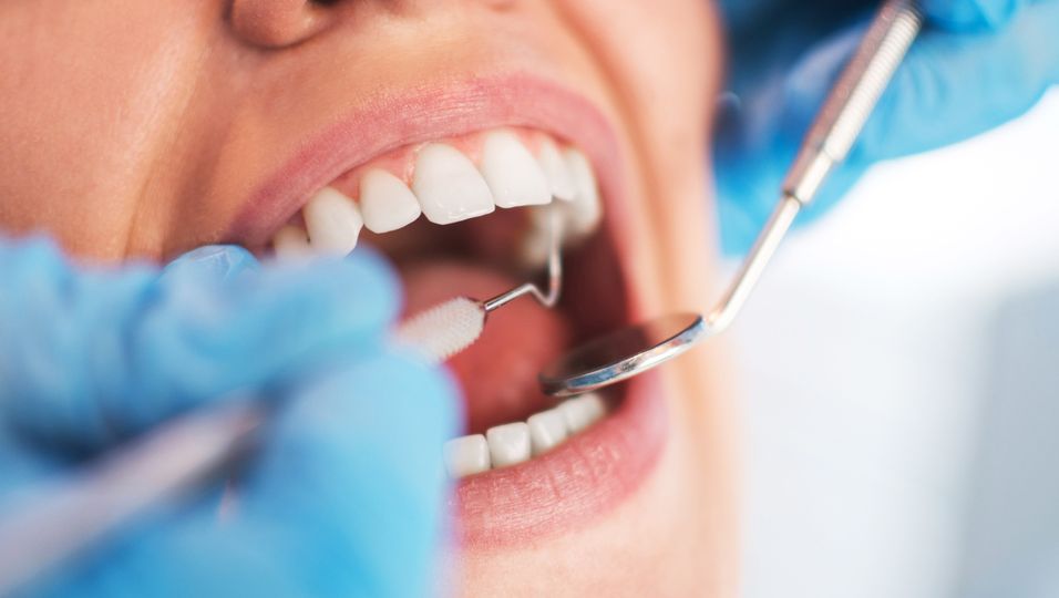 Frau beim Zahnarzt