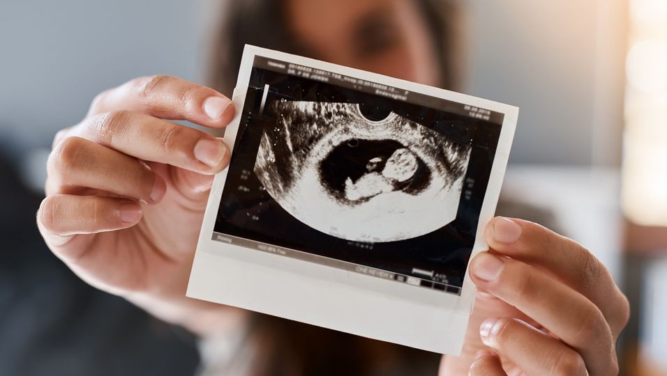 Ultraschall Baby Ultraschallbild personalisierbar Schwangerschaft Foto Bild