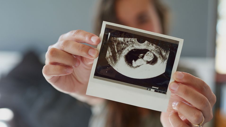 Ultraschall Schwangerschaft, Ultraschalluntersuchung, 3D Ultraschall