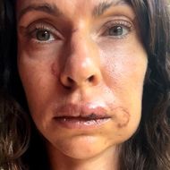 Jana Pallaske: Sie teilt erschreckende Bilder: "Ein Mann versuchte, mich zu vergewaltigen"