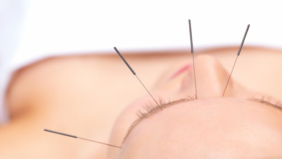 News - Hilft Akupunktur gegen Heuschnupfen?
