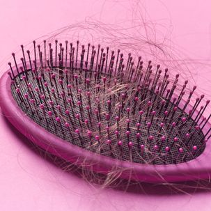 Getestet: So gut ist das gehypte Serum gegen Haarausfall