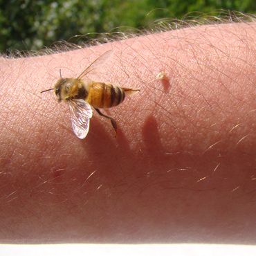 Mann wird 20.000 Mal von Killerbienen gestochen