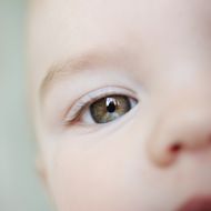 "Er sieht Milchtrunken aus": Lidschwäche als Baby - Endlich kann der kleine Legacy wieder richtig sehen