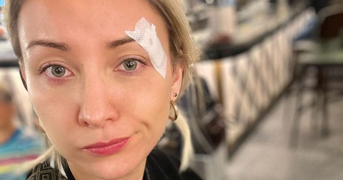Anna-Carina Woitschack: Wunde am Auge: Sie verletzte sich beim Duschen