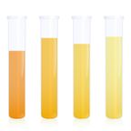 urine of different colors