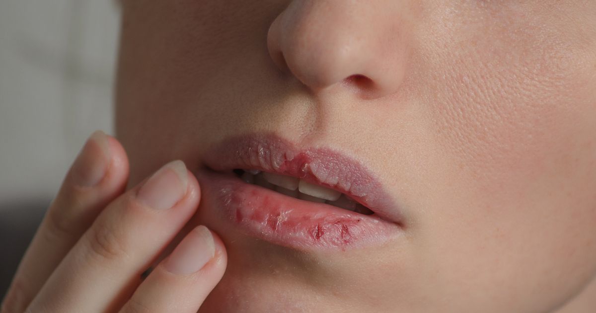 Geschmeidig und schön: 8 Tipps gegen spröde Lippen