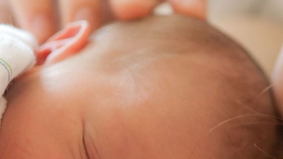 Kaiserschnitt - Natürliche Geburt und Kaiserschnitt