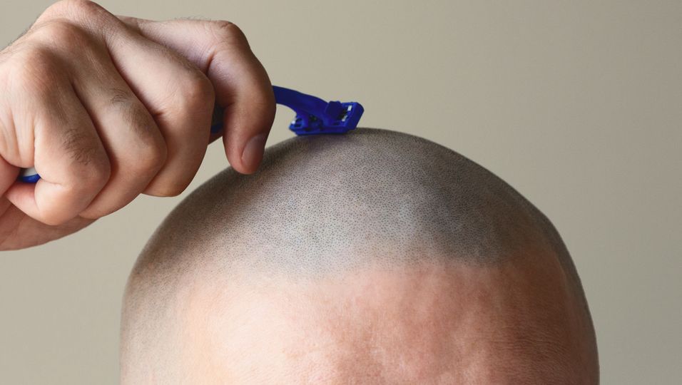 Friseure rasieren sich Kopf für krebskranken Kunden