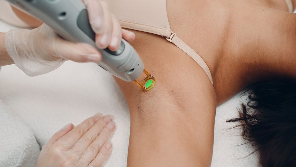 Achsel einer Frau wird mit Lasergerät behandelt